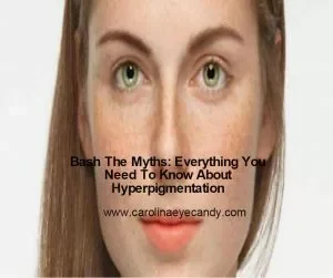 Bash The Myths: Everything You Need To Know About Hyperpigmentation